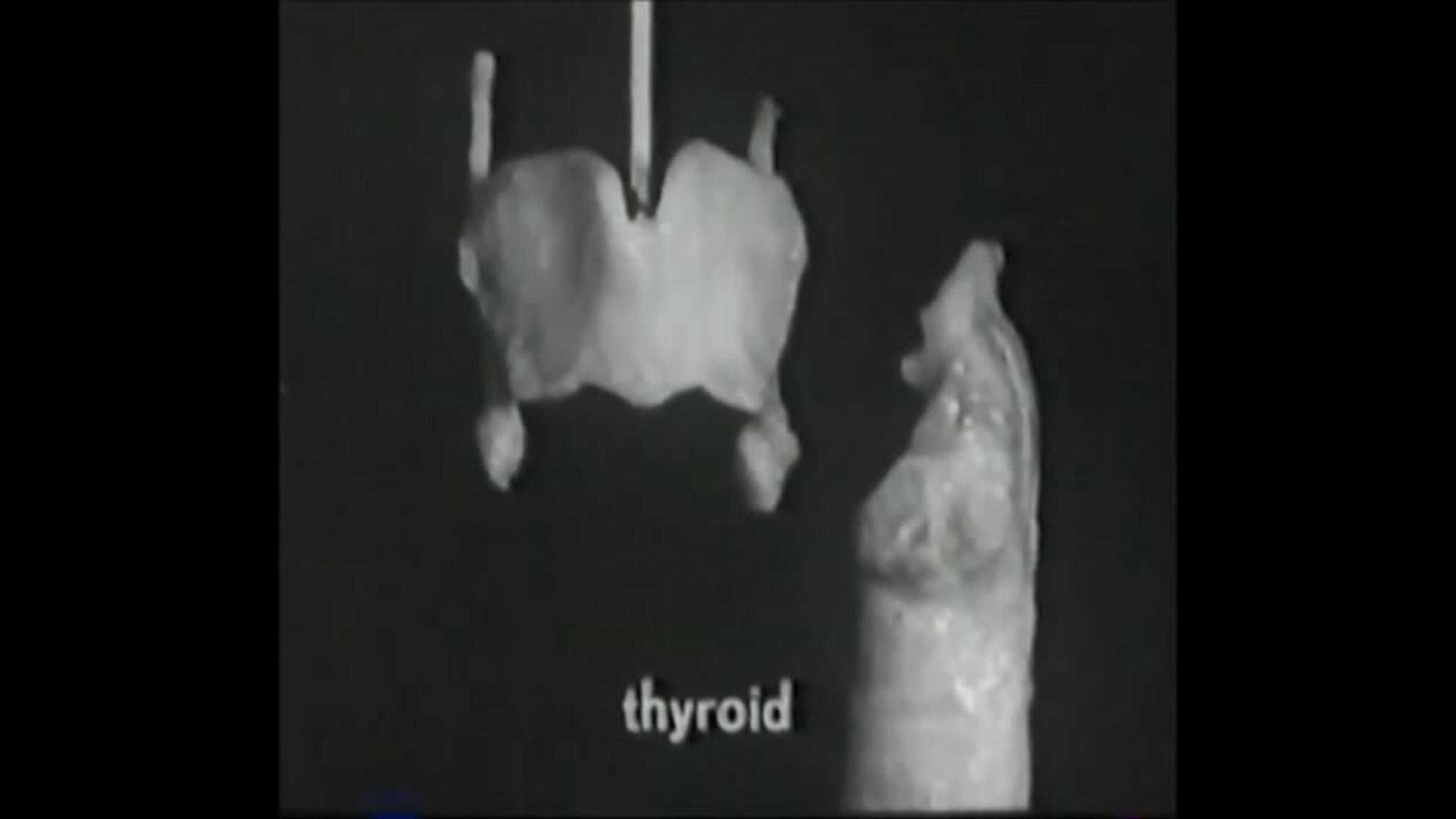 Voice Production: The Vibrating Larynx
