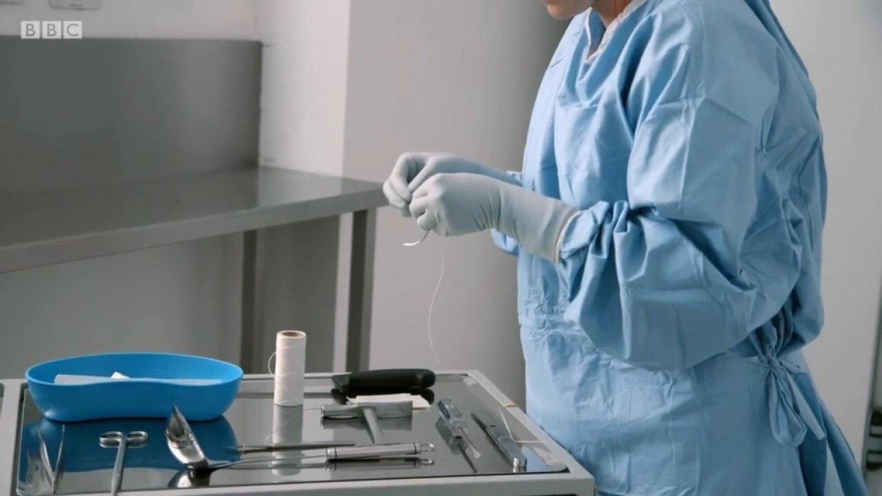 解剖肥胖