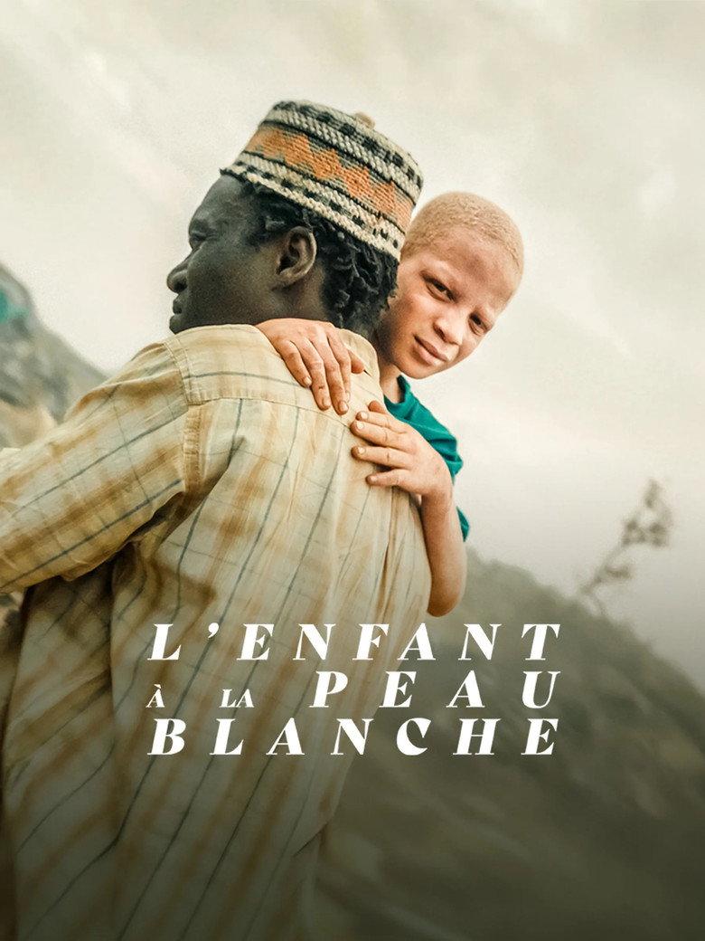 L'Enfant à la Peau Blanche